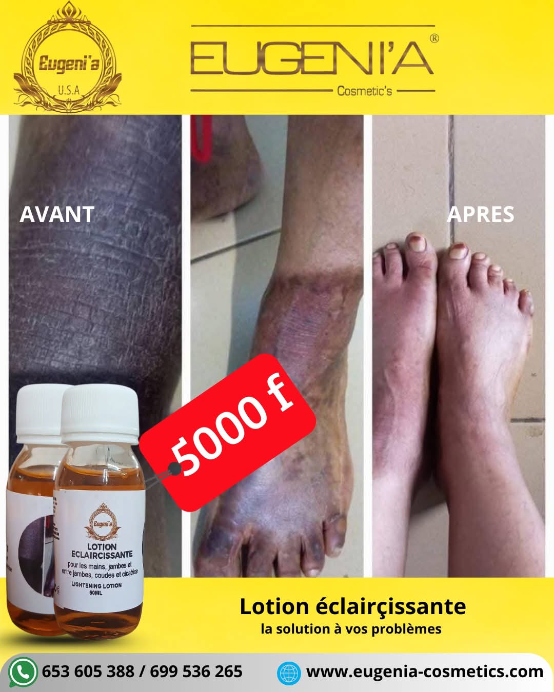 Lotion éclaircissante 